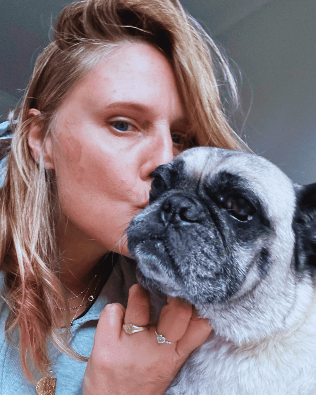 Founder kissing here dog